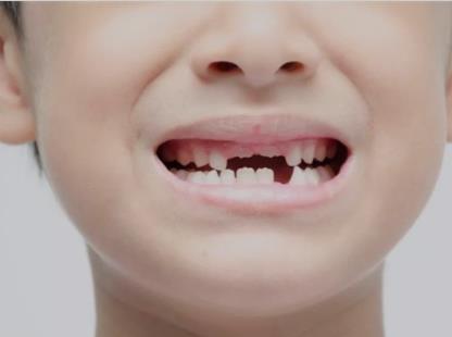 儿童换牙的年龄是多大？儿童换牙的年龄是多大？