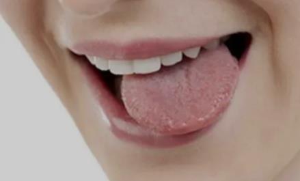 舌头起泡吃什么好 舌头烫起泡了能吃零食吗